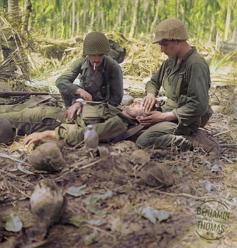 -the-wounds-of-an-Australian-solider-in-New-Guinea.webp